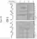 Fig. 17 - METHODS OF TREATING PARKINSON'S DISEASE USING AMINOSTEROL COMPOSITIONS