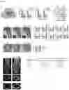 Fig. 02 - MicroRNA 19a/19b for use in treating a pathological condition associated with bone loss or reduced muscle function