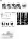 Fig. 03 - MicroRNA 19a/19b for use in treating a pathological condition associated with bone loss or reduced muscle function