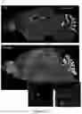 Fig. 52 - Compositions and methods for treating diseases and disorders of the central nervous system