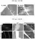 Fig. 04 - Tissue repair by stem cell recruitment and differentiation