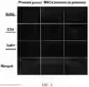 Fig. 04 - STEM CELLS AS AN INDIVIDUALIZED MATERNAL THERAPY FOR PREVENTION OF PREMATURITY