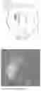 Fig. 16 - Nanoparticle modification of human adipose-derived mesenchymal stem cells for treating brain cancer and other neurological diseases