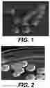 Fig. 02 - Treatment of warts