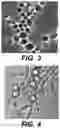 Fig. 03 - Treatment of warts