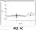 Fig. 06 - Treatment of warts