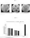 Fig. 14 - Method of inhibiting propionibacterium acnes