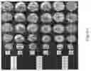 Fig. 18 - METHODS FOR PREVENTING OR TREATING MITOCHONDRIAL PERMEABILITY TRANSITION
