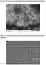 Fig. 03 - Microparticles