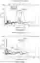 Fig. 19 - METHODS FOR REDUCING LIVER FIBROSIS AND TREATING LYSOSOMAL ACID LIPASE DEFICIENCY IN PATIENTS BASED ON ISHAK FIBROSIS STAGE