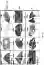 Fig. 12 - Compositions and methods for treating an active infection