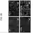 Fig. 11 - Method for treating cancer by administering a toll-like receptor agonist and LAG-3 IgG fusion protein