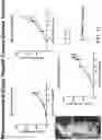 Fig. 12 - RADIOFREQUENCY FIELD HYPERTHERMIA AND SOLID TUMOR IMMUNOMODULATION