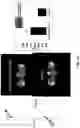 Fig. 13 - Tumor treatment methods using cells that localize to the tumor