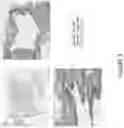 Fig. 04 - Ice-based lipid nanoparticle formulation for delivery of mRNA