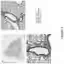 Fig. 08 - Ice-based lipid nanoparticle formulation for delivery of mRNA