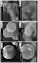 Fig. 08 - Curcumin-based magnetic nanostructured system for dual response of imaging and therapeutics