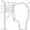 Fig. 01 - Generating cold plasma away from skin, and associated systems and methods