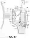 Fig. 19 - Generating cold plasma away from skin, and associated systems and methods