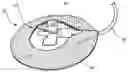 Fig. 01 - Protective Dressing For Skin-Placed Medical Device