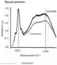 Fig. 14 - Light-adjustable hydrogel and bioanalogic intraocular lens