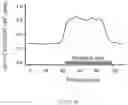 Fig. 16 - Light-adjustable hydrogel and bioanalogic intraocular lens