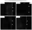 Fig. 05 - Methods of preparing personalized blood vessels