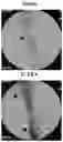 Fig. 01 - Methods of preparing personalized blood vessels