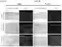 Fig. 03 - Methods of preparing personalized blood vessels