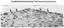Fig. 06 - Methods of preparing personalized blood vessels