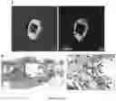 Fig. 08 - Zwitterionic hydrogels for delivery of biomolecules