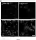 Fig. 09 - Zwitterionic hydrogels for delivery of biomolecules