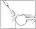 Fig. 01 - Novel Implantable Devices And Related Methods And Materials