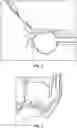 Fig. 02 - Novel Implantable Devices And Related Methods And Materials