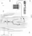 Fig. 02 - Endovascular perfusion augmentation for critical care