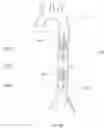 Fig. 04 - Endovascular perfusion augmentation for critical care