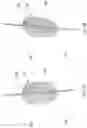 Fig. 05 - Endovascular perfusion augmentation for critical care