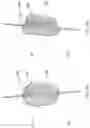 Fig. 06 - Endovascular perfusion augmentation for critical care
