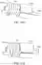 Fig. 19 - Methods and systems for treatment of acute ischemic stroke
