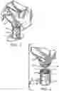 Fig. 02 - Abscess irrigation systems