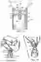 Fig. 10 - Abscess irrigation systems