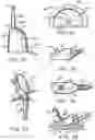 Fig. 14 - Abscess irrigation systems