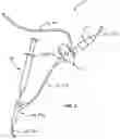 Fig. 03 - Labeling system and method for ports in intravenous systems