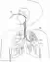Fig. 01 - Methods and devices for passive residual lung volume reduction and functional lung volume expansion