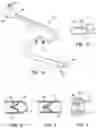 Fig. 02 - Methods and devices for passive residual lung volume reduction and functional lung volume expansion