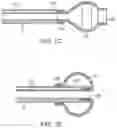 Fig. 03 - Methods and devices for passive residual lung volume reduction and functional lung volume expansion
