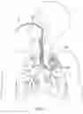 Fig. 08 - Methods and devices for passive residual lung volume reduction and functional lung volume expansion