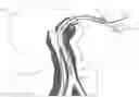 Fig. 01 - ORALLY-PLACED LINE SECUREMENT CLIP