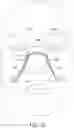 Fig. 09 - STRAPLESS NASAL INTERFACE DEVICE