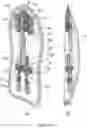 Fig. 12 - Catheter securement device